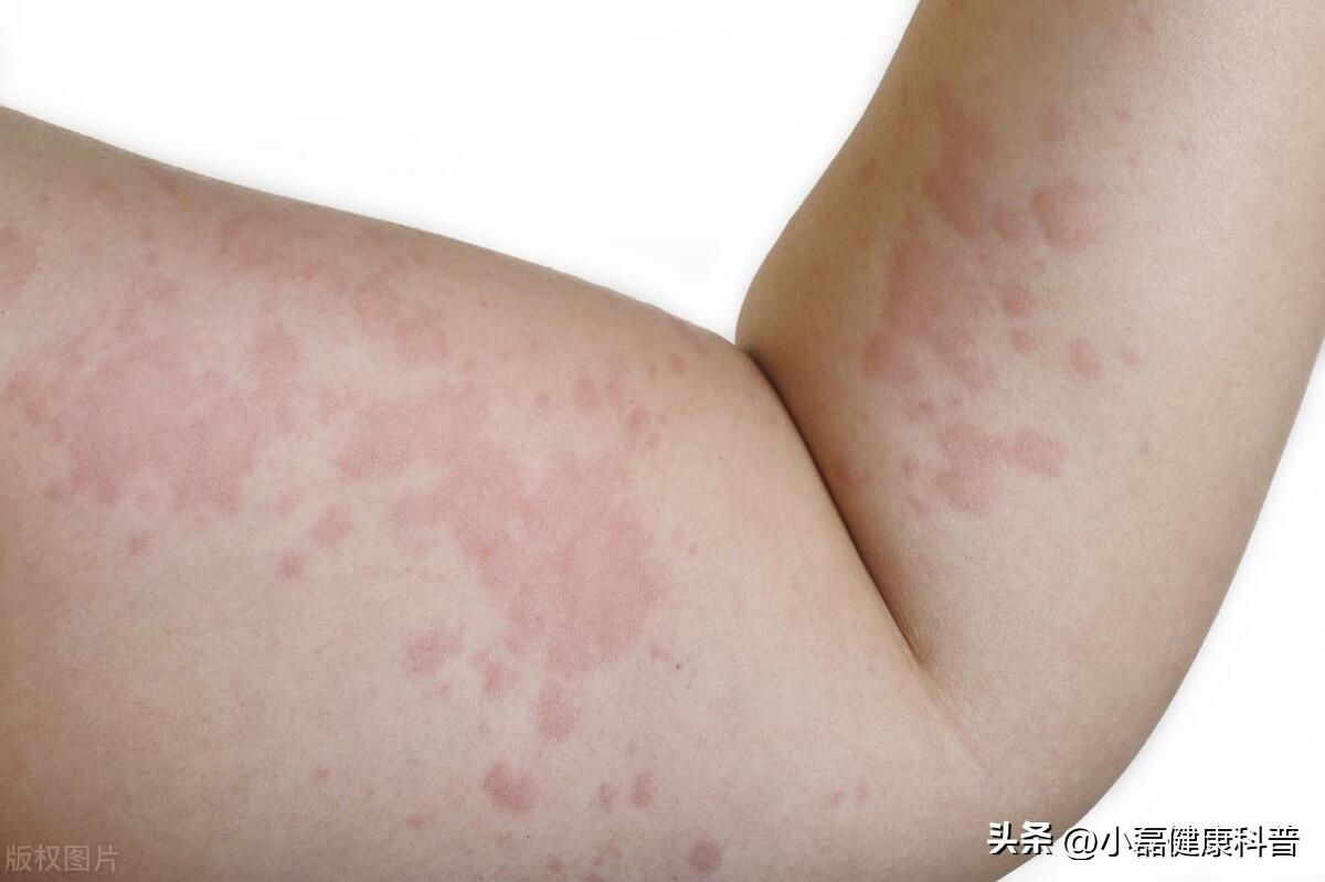养生吃什么坚果好_吃坚果养生吗_养生坚果吃好还是吃好
